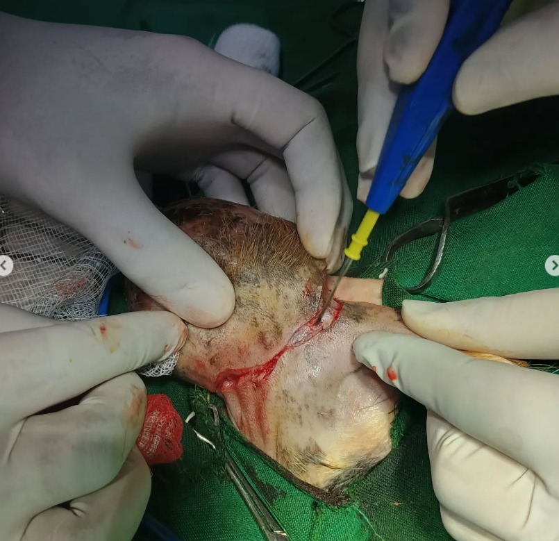 surgery-0